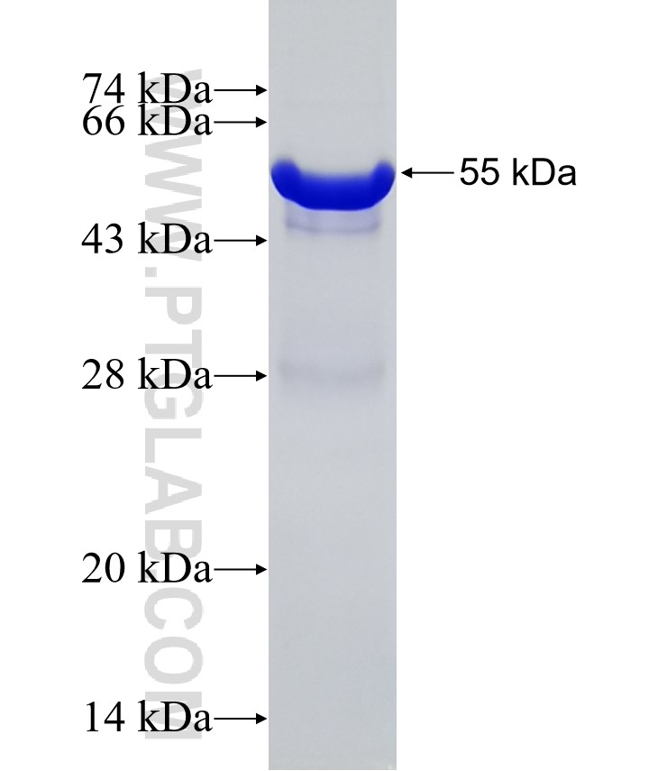 KIAA0090 fusion protein Ag31377 SDS-PAGE KIAA0090 fusion protein Ag31377 SDS-PAGE