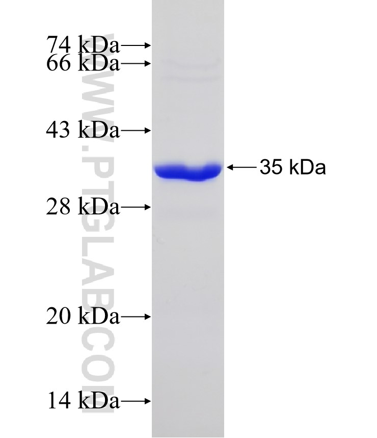 KIAA0090 fusion protein Ag31389 SDS-PAGE KIAA0090 fusion protein Ag31389 SDS-PAGE