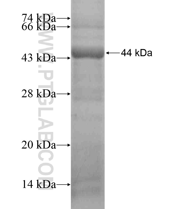 KIAA0100 fusion protein Ag17261 SDS-PAGE KIAA0100 fusion protein Ag17261 SDS-PAGE