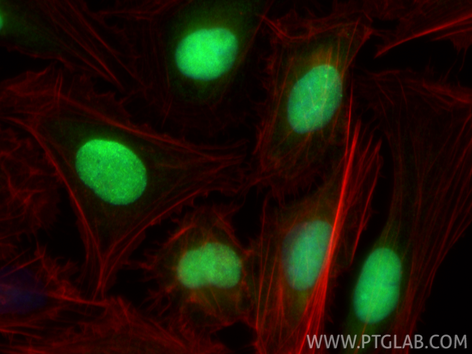IF Staining of U2OS using 20537-1-AP IF Staining of U2OS using 20537-1-AP