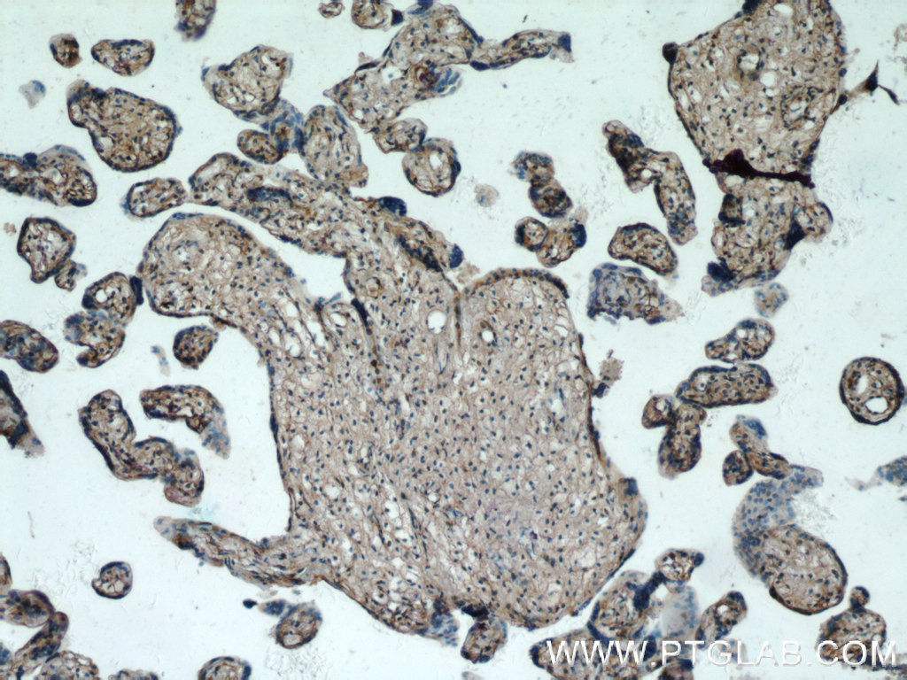 Immunohistochemical analysis of paraffin-embedded human placenta tissue slide using 25195-1-AP (<a class='green' href='/productredirect?CatalogNo=KIAA0125' target='_blank'>KIAA0125</a> antibody at dilution of 1:50 (under 10x lens). IHC staining of human placenta using 25195-1-AP