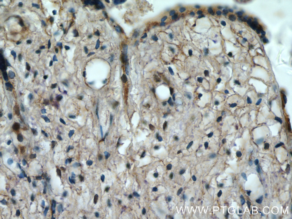 Immunohistochemical analysis of paraffin-embedded human placenta tissue slide using 25195-1-AP (<a class='green' href='/productredirect?CatalogNo=KIAA0125' target='_blank'>KIAA0125</a> antibody at dilution of 1:50 (under 40x lens). IHC staining of human placenta using 25195-1-AP