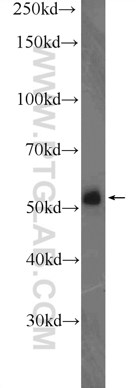 WB analysis of mouse lung using 21904-1-AP