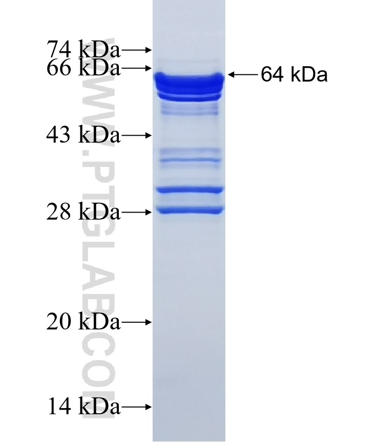 KIAA0141 fusion protein Ag14615 SDS-PAGE