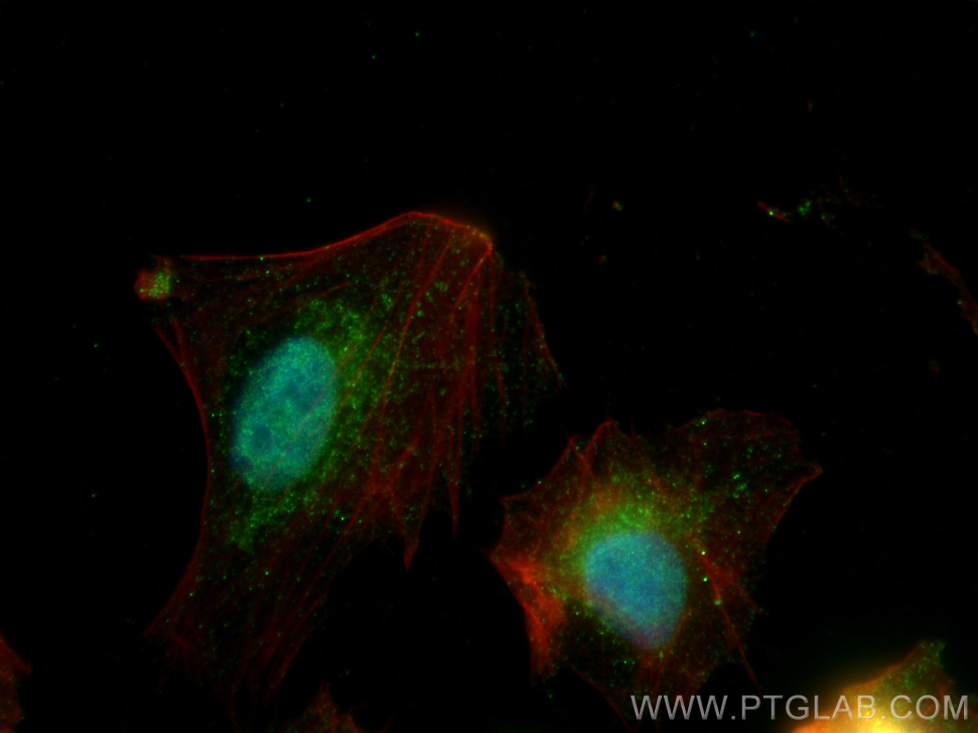 IF Staining of U2OS using 24947-1-AP