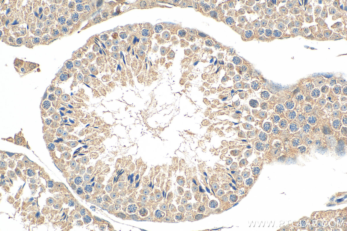 IHC staining of mouse testis using 24947-1-AP