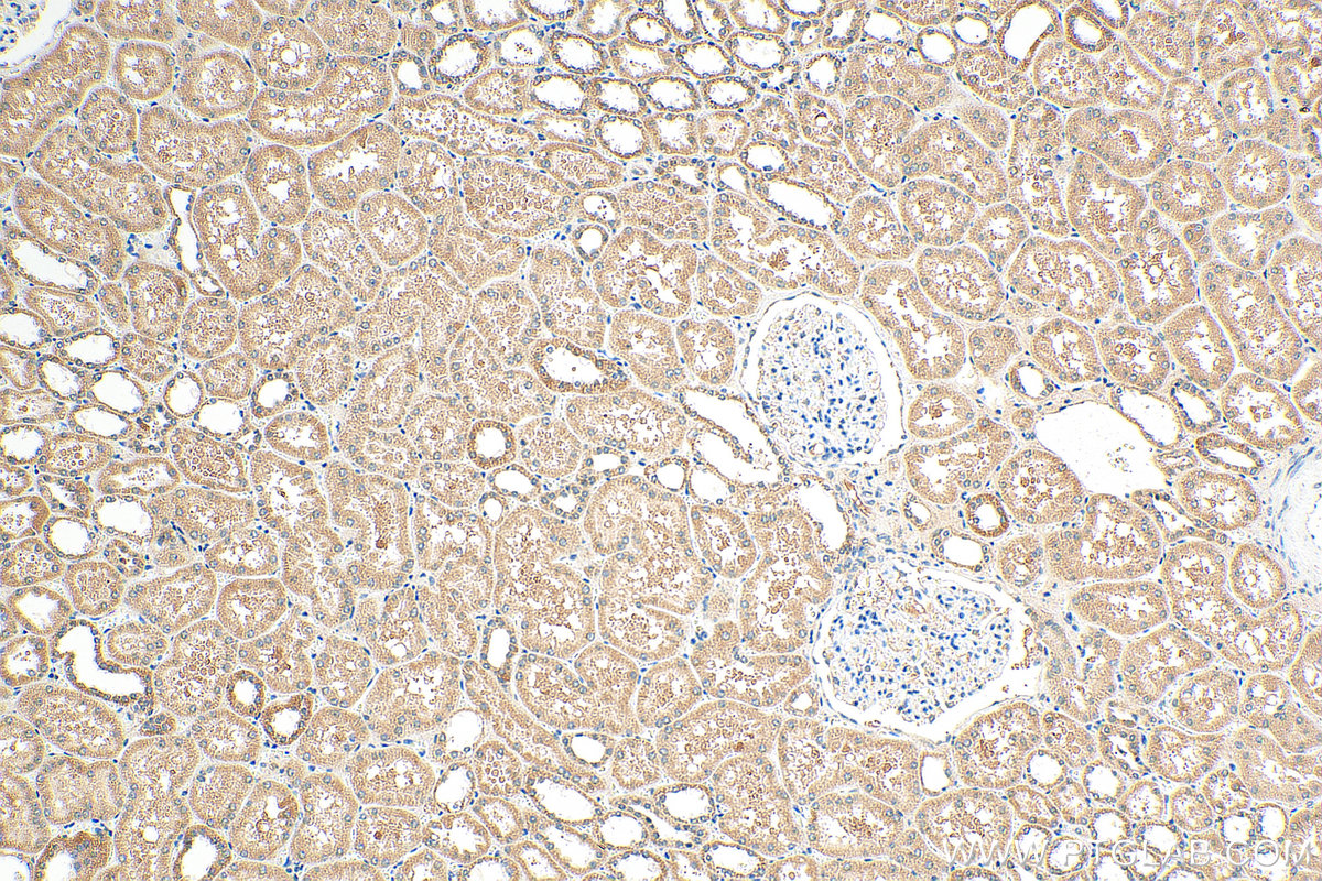 IHC staining of human kidney using 24947-1-AP