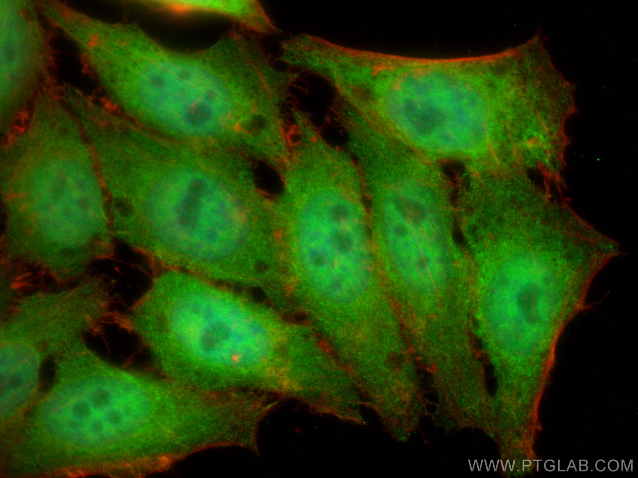 IF Staining of HepG2 using 21444-1-AP