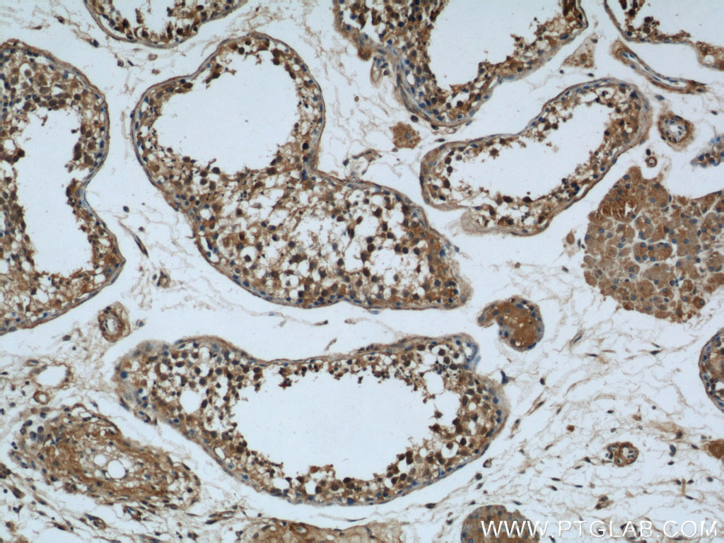 IHC staining of human testis using 21444-1-AP