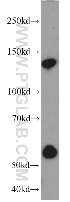 WB analysis of mouse liver using 21444-1-AP