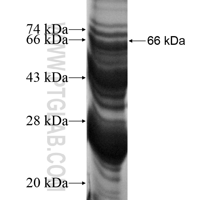 KIAA0226 fusion protein Ag13713 SDS-PAGE KIAA0226 fusion protein Ag13713 SDS-PAGE