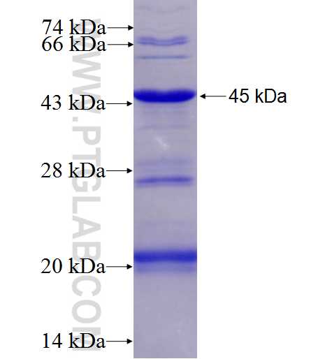 KIAA0284 fusion protein Ag26852 SDS-PAGE