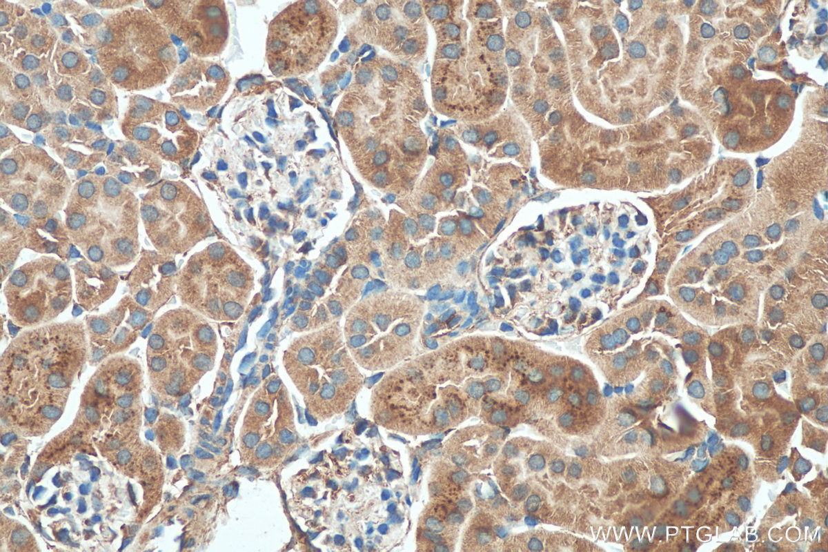 IHC staining of mouse kidney using 25623-1-AP