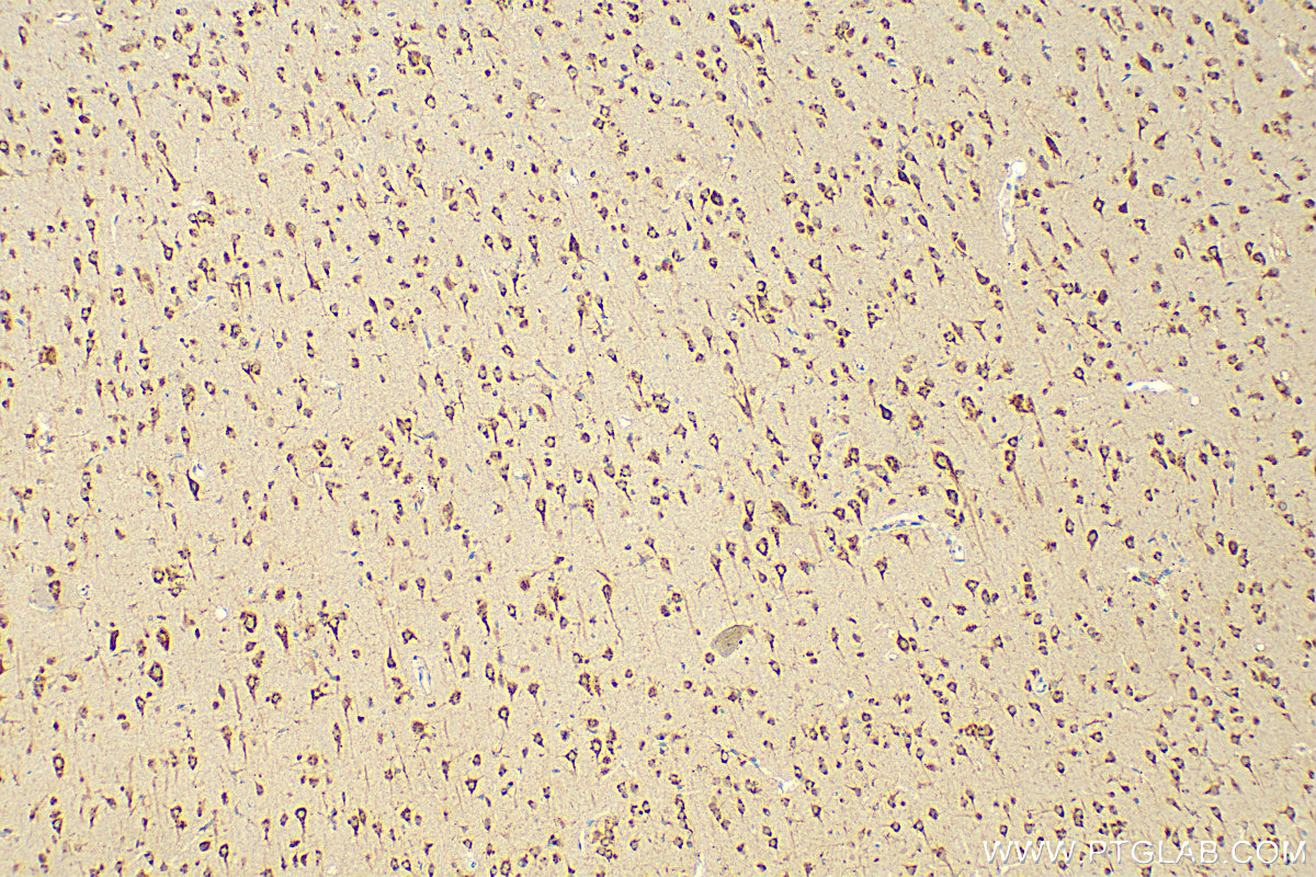 IHC staining of rat brain using 21016-1-AP