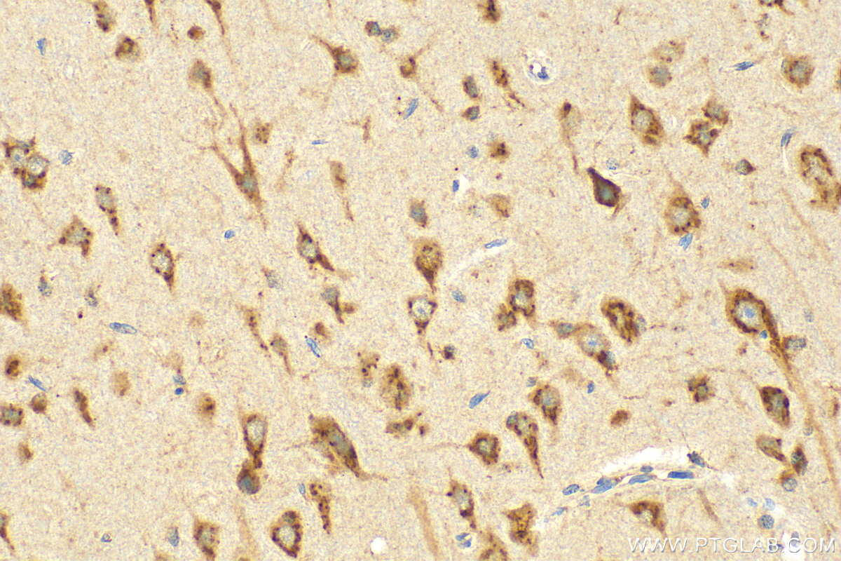 IHC staining of rat brain using 21016-1-AP