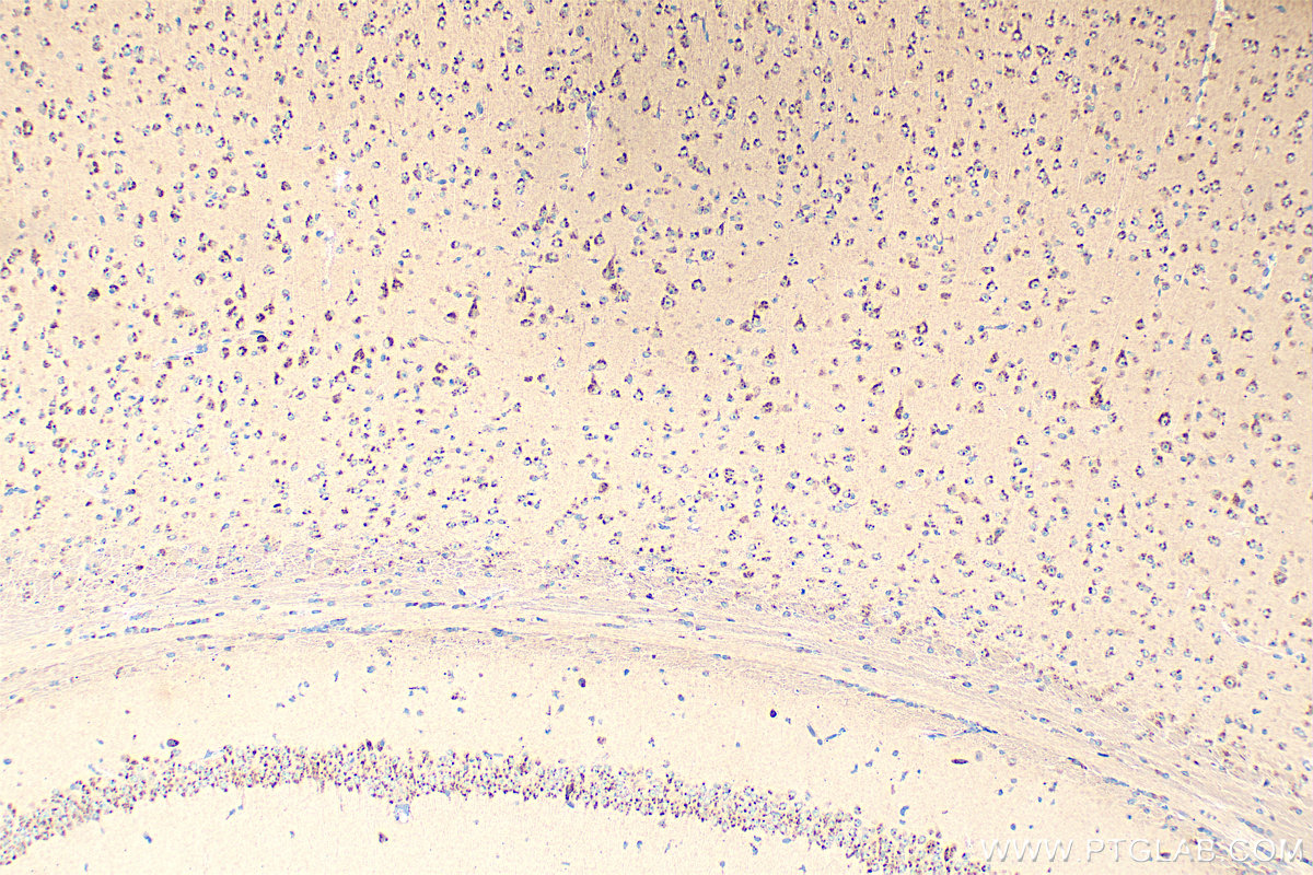 IHC staining of mouse brain using 21016-1-AP