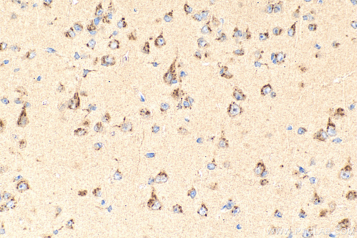 IHC staining of mouse brain using 21016-1-AP