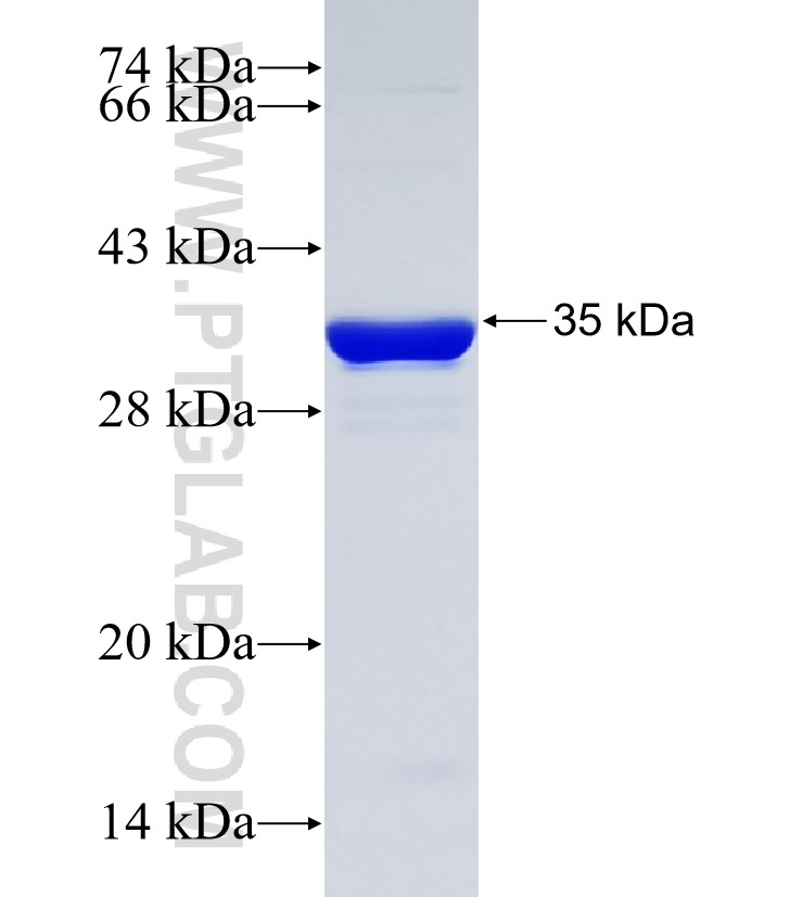 KIAA0323 fusion protein Ag35413 SDS-PAGE KIAA0323 fusion protein Ag35413 SDS-PAGE