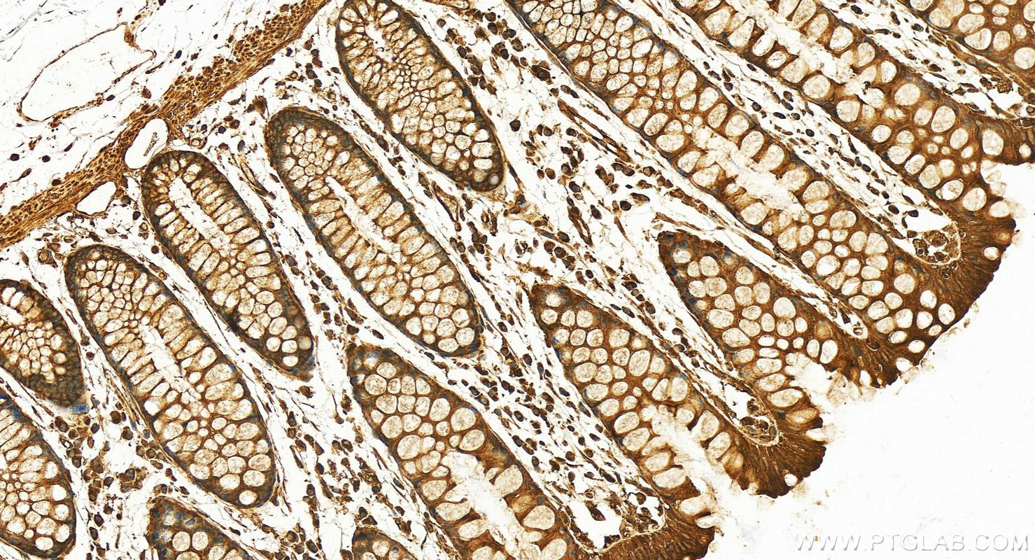 IHC staining of human colon using 12345-1-AP