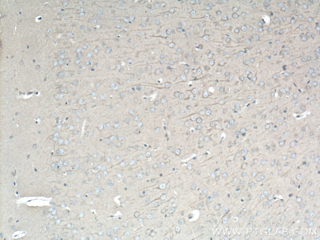 IHC staining of mouse brain using 12345-1-AP