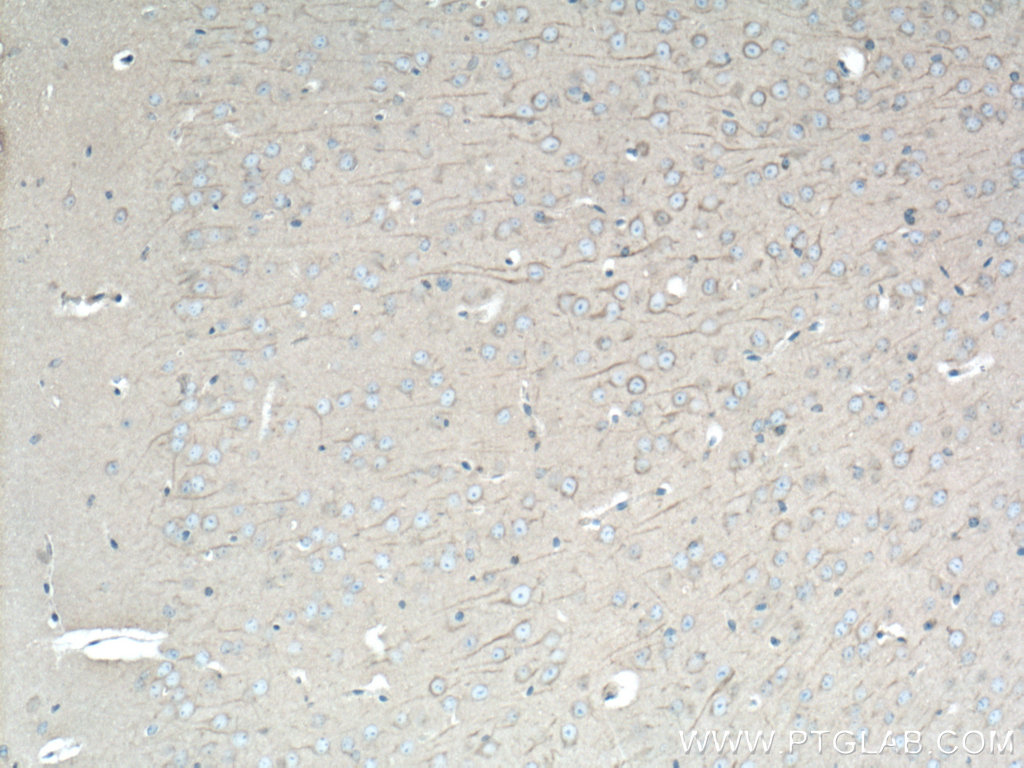 IHC staining of mouse brain using 12345-1-AP