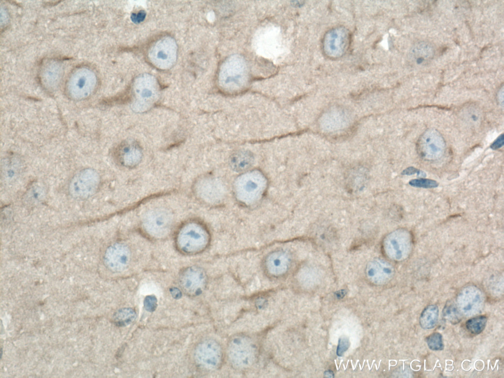 IHC staining of mouse brain using 12345-1-AP