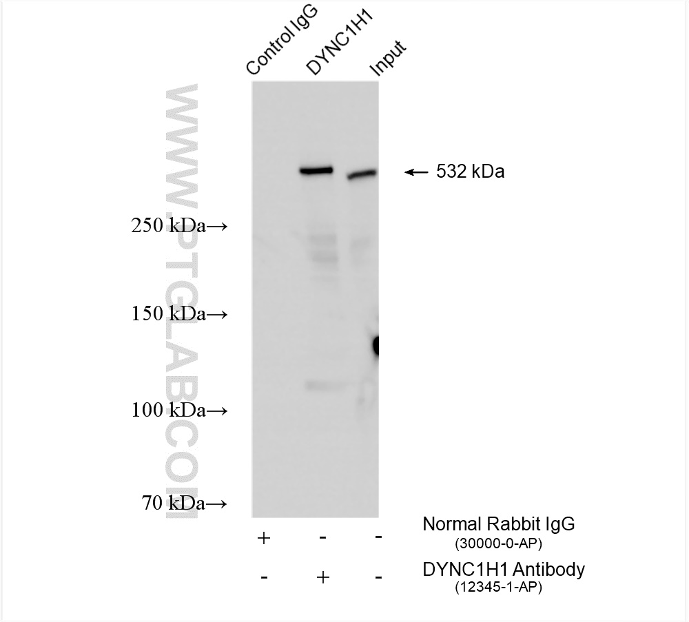 IP experiment of HeLa using 12345-1-AP
