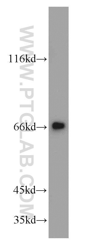 WB analysis of mouse brain using 20959-1-AP