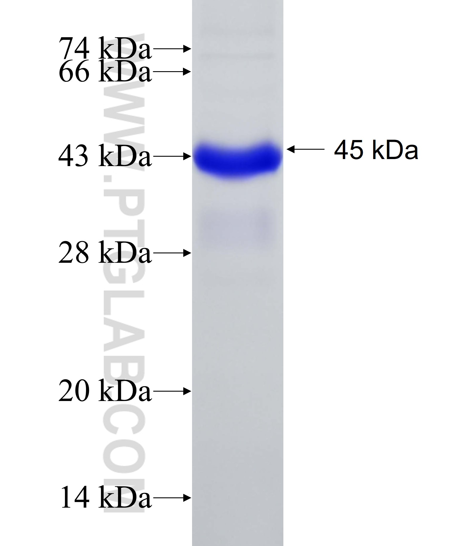 KIAA0391 fusion protein Ag15629 SDS-PAGE