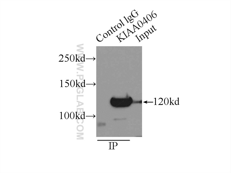 IP experiment of HeLa using 22381-1-AP