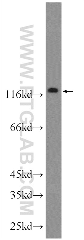 WB analysis of HeLa using 22381-1-AP