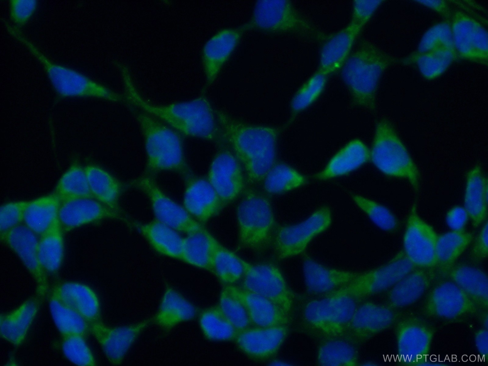 IF Staining of HEK-293 using 25233-1-AP