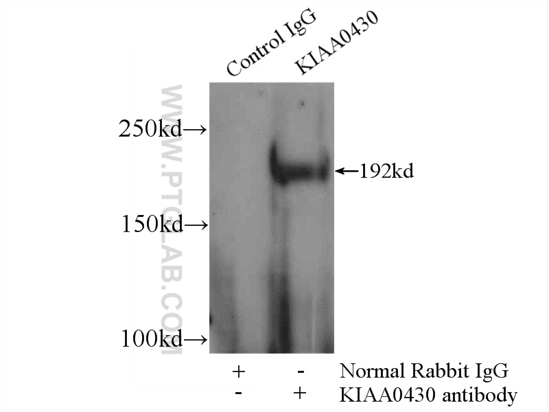 IP experiment of HeLa using 25233-1-AP