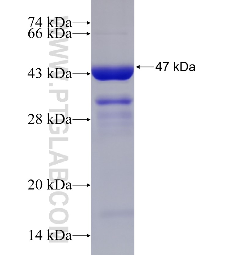KIAA0494 fusion protein Ag33197 SDS-PAGE