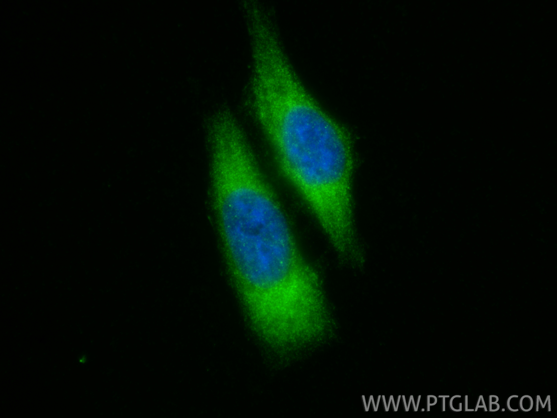 IF Staining of HepG2 using 21478-1-AP IF Staining of HepG2 using 21478-1-AP