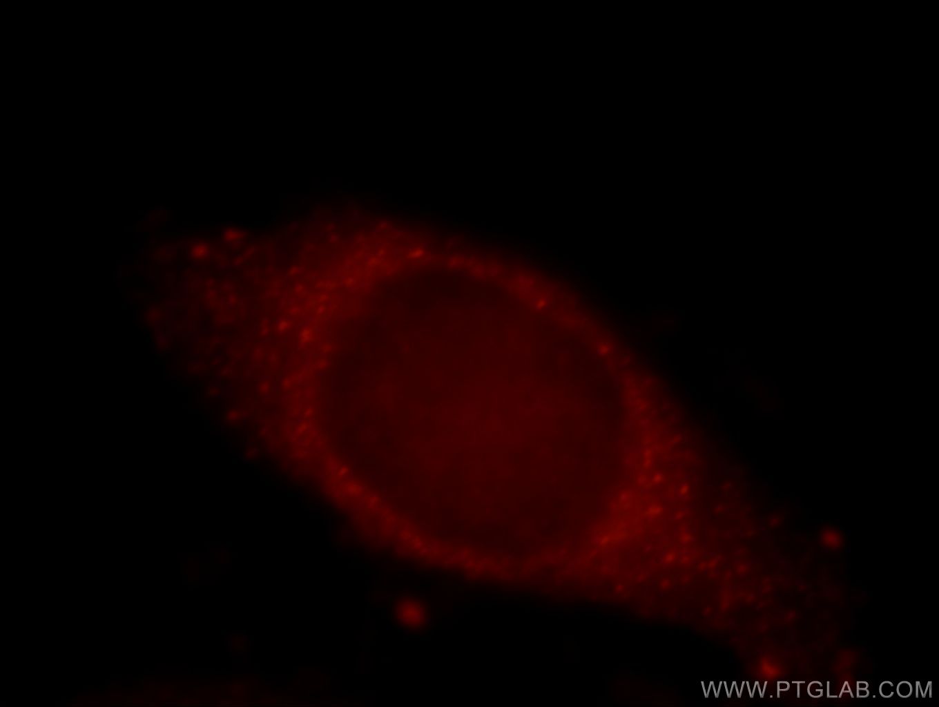 IF Staining of HepG2 using 21138-1-AP