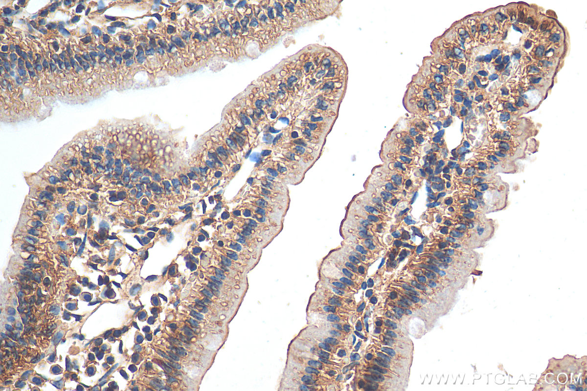 IHC staining of mouse small intestine using 21138-1-AP