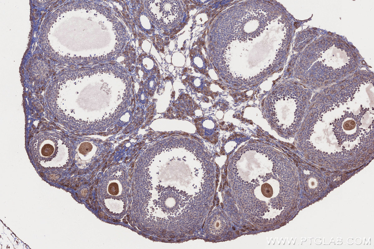 IHC staining of mouse ovary using 21138-1-AP IHC staining of mouse ovary using 21138-1-AP