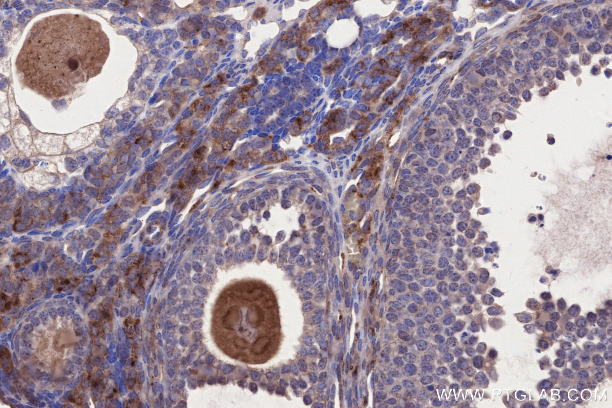 IHC staining of mouse ovary using 21138-1-AP IHC staining of mouse ovary using 21138-1-AP