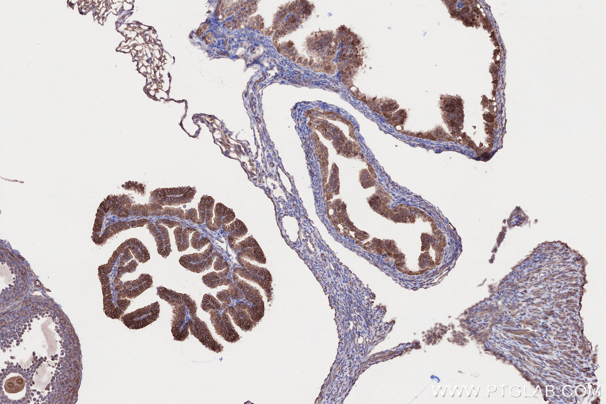 IHC staining of mouse ovary using 21138-1-AP IHC staining of mouse ovary using 21138-1-AP