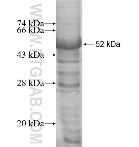 KIAA0528 fusion protein Ag15769 SDS-PAGE KIAA0528 fusion protein Ag15769 SDS-PAGE