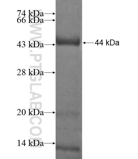 KIAA0556 fusion protein Ag20260 SDS-PAGE KIAA0556 fusion protein Ag20260 SDS-PAGE