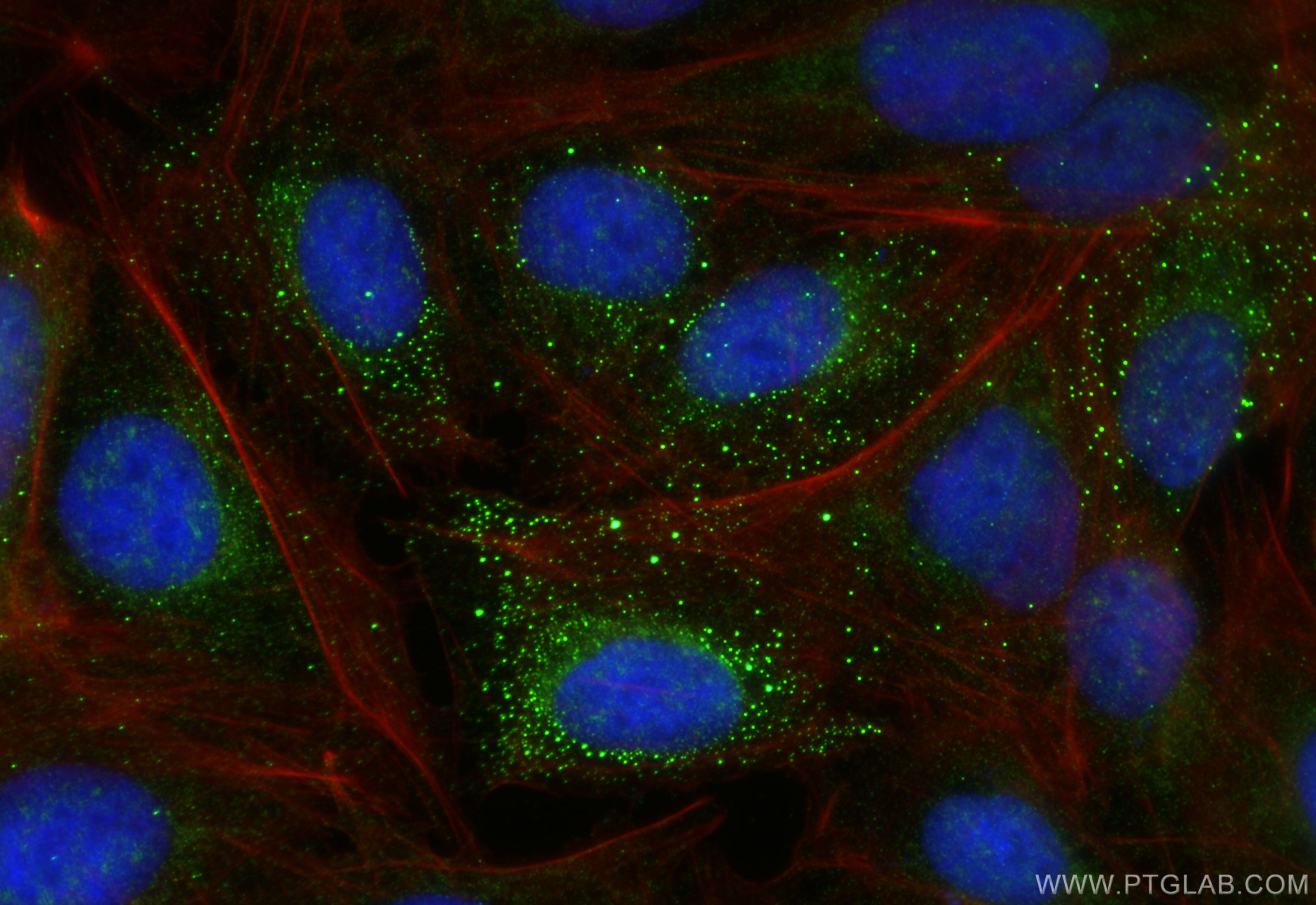 IF Staining of U2OS using 31348-1-AP