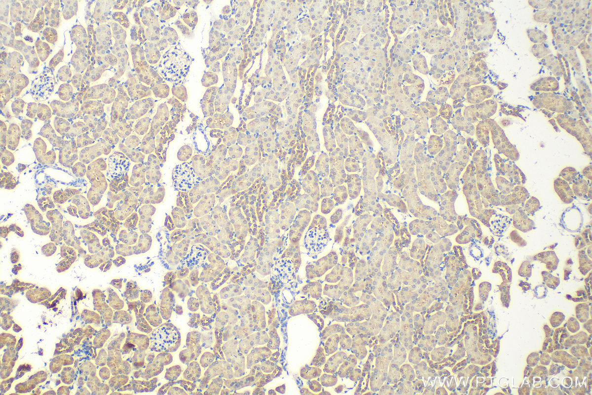 IHC staining of mouse kidney using 31348-1-AP