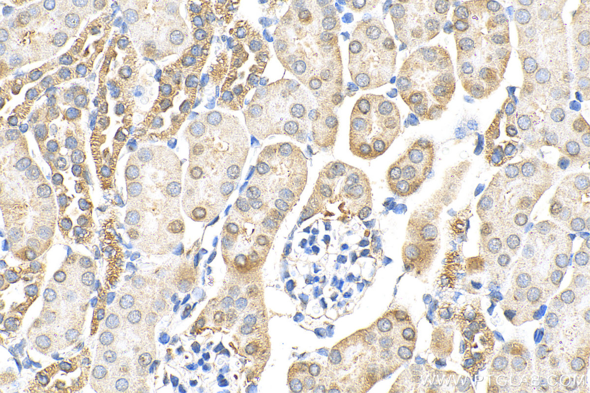IHC staining of mouse kidney using 31348-1-AP