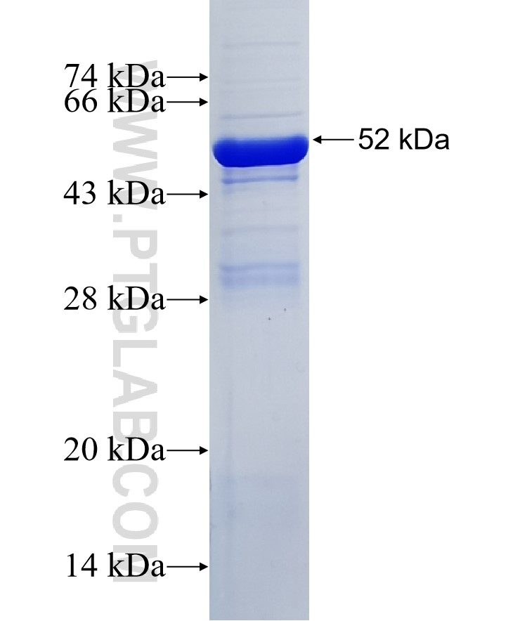 KIAA0564 fusion protein Ag35404 SDS-PAGE
