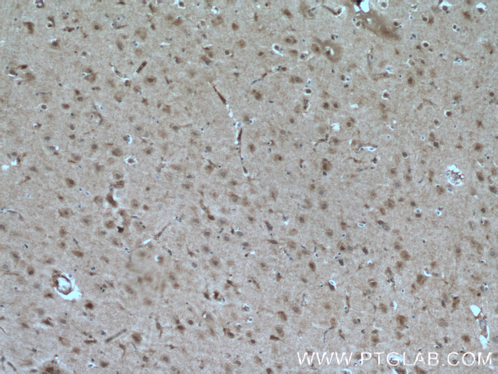 IHC staining of human brain using 24421-1-AP