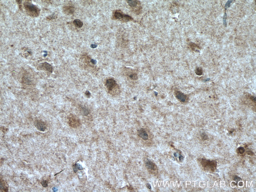 IHC staining of human brain using 24421-1-AP