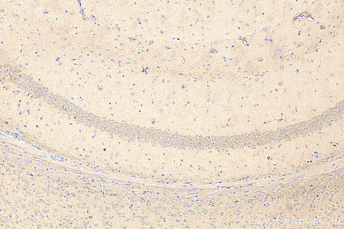 Immunohistochemical analysis of paraffin-embedded mouse brain tissue slide using 24421-1-AP (TALPID3 antibody) at dilution of 1:400 (under 10x lens). Heat mediated antigen retrieval with Tris-EDTA buffer (pH 9.0). IHC staining of mouse brain using 24421-1-AP