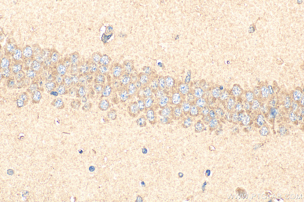 Immunohistochemical analysis of paraffin-embedded mouse brain tissue slide using 24421-1-AP (TALPID3 antibody) at dilution of 1:400 (under 40x lens). Heat mediated antigen retrieval with Tris-EDTA buffer (pH 9.0). IHC staining of mouse brain using 24421-1-AP